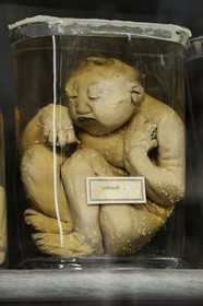 France, Hérault (34), Montpellier, centre historique, faculté de médecine, le musée d'anatomie, foetus de la collection de tératologie qui est l'étude scientifique des malformations congénitales