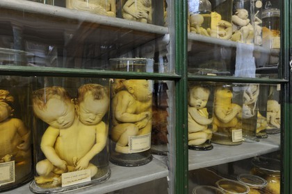 France, Hérault (34), Montpellier, centre historique, faculté de médecine, le musée d'anatomie, foetus de la collection de tératologie qui est l'étude scientifique des malformations congénitales