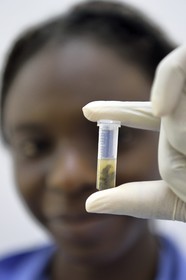 Namibia, Otjiwarongo, Cheetah Conservation Fund, research and education centre, extraction by Harmony of cheetah's feces in a micro tube in order to extract DNA